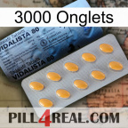 3000 Tabs 44